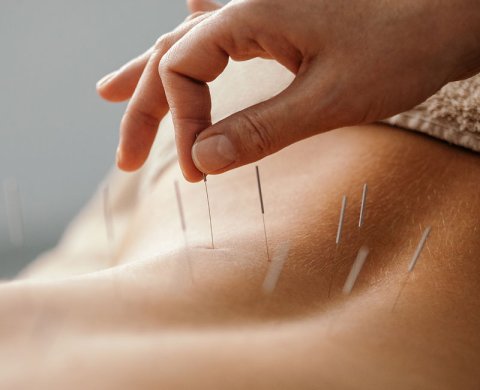 Yi Acupuncture & Chinese Medicine