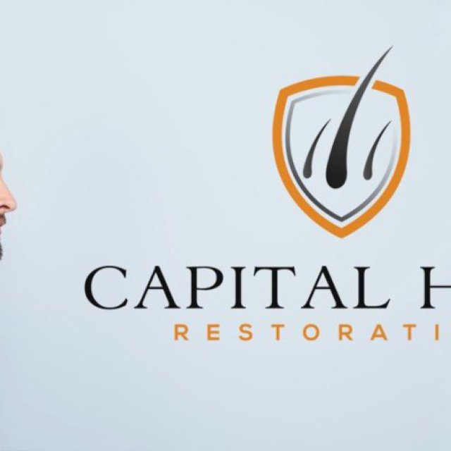 Capital Hair Restoration - Hair Transplant